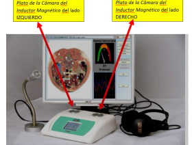 Equipo Biolaz Oberon - HEALTH TECH - Bioresonancia OBERON